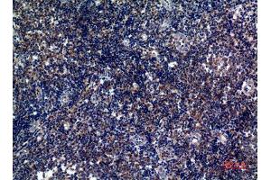 Immunohistochemistry (IHC) analysis of paraffin-embedded Human Tonsils, antibody was diluted at 1:100. (ICOS 抗体)