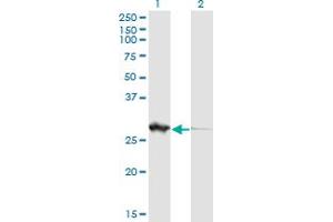 Western Blot analysis of PGLS expression in transfected 293T cell line by PGLS monoclonal antibody (M01), clone 2D9.