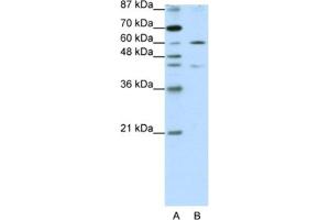 Western Blotting (WB) image for anti-Zinc Finger Protein 496 (ZNF496) antibody (ABIN2461953) (ZNF496 抗体)