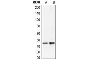 Western Blotting (WB) image for anti-serpin Peptidase Inhibitor, Clade A (Alpha-1 Antiproteinase, Antitrypsin), Member 5 (SERPINA5) (Center) antibody (ABIN7298574)