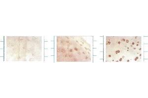 EC SOD (4GG11G6), Human cartilage, ICC Left control, middle young, right cartilage with osterarthritis (SOD3 抗体)