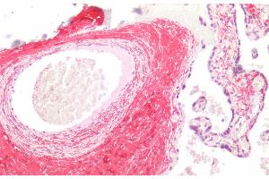 Immunohistochemistry (IHC) image for anti-Cross-Linked C-Telopeptides of Type I Collagen (CTX-I) antibody (ABIN7427822)