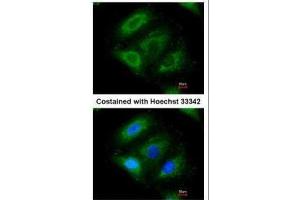 ICC/IF Image Immunofluorescence analysis of paraformaldehyde-fixed A549, using ERAB , antibody at 1:200 dilution. (HSD17B10 抗体  (C-Term))