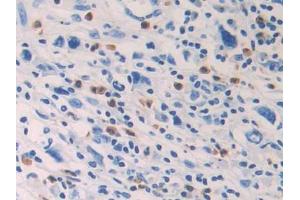 Immunohistochemistry (IHC) image for anti-Prostaglandin D2 Synthase (PTGDS) (AA 1-199) antibody (ABIN1870061)