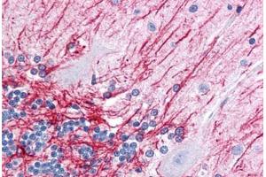 Human Brain, Cerebellum: Formalin-Fixed, Paraffin-Embedded (FFPE) (GFAP 抗体)
