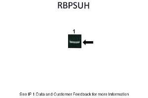 Immunoprecipitation (IP) image for anti-Recombination Signal Binding Protein For Immunoglobulin kappa J Region (RBPJ) (C-Term) antibody (ABIN2777213)
