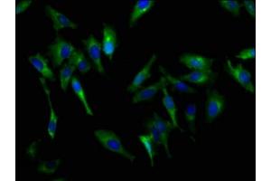 Immunofluorescence staining of Hela cells with ABIN7146245 at 1:200, counter-stained with DAPI. (Cadherin 9 抗体  (AA 131-314))