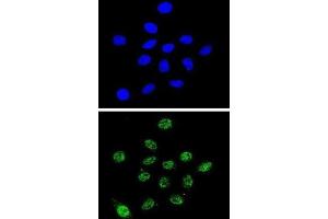 Immunofluorescence (IF) image for anti-Dyskeratosis Congenita 1, Dyskerin (DKC1) antibody (ABIN3002360) (DKC1 抗体)