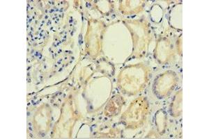 Immunohistochemistry of paraffin-embedded human kidney tissue using ABIN7168739 at dilution of 1:100 (PLA2R1 抗体  (AA 395-530))