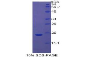 SDS-PAGE analysis of Cow Cyclophilin A Protein. (PPIA 蛋白)