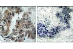 Immunohistochemistry (IHC) image for anti-BCL2-Associated Agonist of Cell Death (BAD) (AA 102-151), (pSer99) antibody (ABIN1531782)