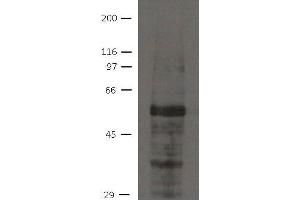 Image no. 1 for anti-Ajuba LIM Protein (AJUBA) antibody (ABIN1169674) (AJUBA 抗体)