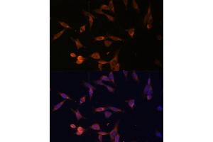 Immunofluorescence analysis of NIH-3T3 cells using UMPS Polyclonal Antibody (ABIN6128901, ABIN6149927, ABIN6149929 and ABIN6217183) at dilution of 1:100 (40x lens). (UMPS 抗体  (AA 100-260))