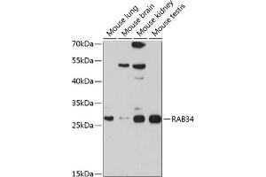 Western blot analysis of extracts of various cell lines, using R antibody (ABIN6133004, ABIN6146574, ABIN6146575 and ABIN6214549) at 1:1000 dilution. (RAB34 抗体  (AA 1-259))