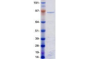 Western Blotting (WB) image for Zinc Finger Protein 148 (ZNF148) protein (Myc-DYKDDDDK Tag) (ABIN2735925)