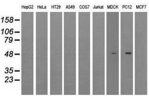 Image no. 6 for anti-Lysyl Oxidase (LOX) (AA 22-168) antibody (ABIN1491218) (LOX 抗体  (AA 22-168))