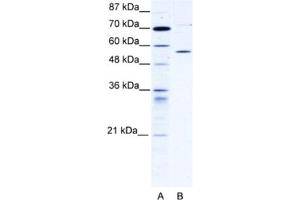 Western Blotting (WB) image for anti-Chaperonin Containing TCP1, Subunit 4 (Delta) (CCT4) antibody (ABIN2460902) (CCT4 抗体)