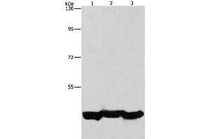 Western Blot analysis of A549 cell and Mouse liver tissue, hepG2 cell using PGK1 Polyclonal Antibody at dilution of 1:1000 (PGK1 抗体)
