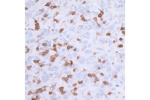 Immunohistochemistry (IHC) image for anti-CD3 epsilon (CD3E) (AA 157-207) antibody (ABIN7454035) (Recombinant CD3 epsilon 抗体  (AA 157-207))