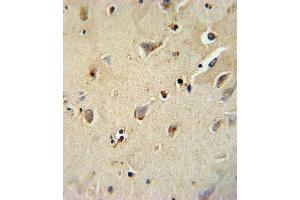 Immunohistochemistry (Paraffin-embedded Sections) (IHC (p)) image for anti-ATPase, Na+/K+ Transporting, beta 1 Polypeptide (ATP1B1) (AA 112-138) antibody (ABIN652047)