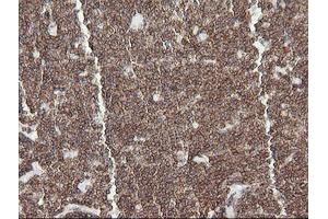 Image no. 1 for anti-Differentially Expressed in FDCP 6 Homolog (DEF6) antibody (ABIN1497808) (DEF6 抗体)