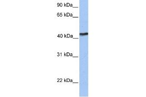 WB Suggested Anti-TMEM149 Antibody Titration:  0. (IGF-like family receptor 1 (IGFLR1) (N-Term) 抗体)