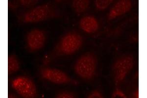 Immunofluorescence staining of methanol-fixed MCF7 cells using PKCb(phospho-Thr641) antibody. (PKC beta 抗体  (pThr641))