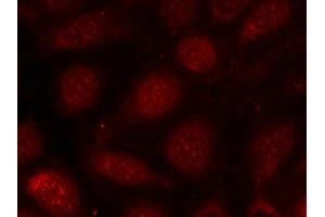 Immunofluorescence staining of methanol-fixed MCF7 cells using PKCb(phospho-Thr641) antibody. (PKC beta 抗体  (pThr641))