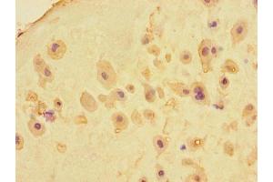 Immunohistochemistry of paraffin-embedded human placenta tissue using ABIN7159183 at dilution of 1:100 (RIKEN cDNA 4930404A10 Gene (4930404A10RIK) (AA 18-91) 抗体)