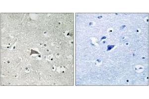 Immunohistochemistry analysis of paraffin-embedded human brain tissue, using VEGFR1 (Ab-1048) Antibody. (FLT1 抗体  (AA 1016-1065))