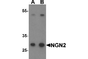 Western Blotting (WB) image for anti-Neurogenin 2 (NEUROG2) (C-Term) antibody (ABIN1077397) (Neurogenin 2 抗体  (C-Term))