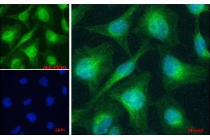 ABIN1590007 Immunofluorescence analysis of paraformaldehyde fixed HeLa cells, permeabilized with 0. (Patched 1 抗体  (AA 266-280))