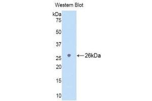 Western Blotting (WB) image for anti-Lymphocyte Antigen 9 (CD229) (AA 2-212) antibody (ABIN1174910) (LY9 抗体  (AA 2-212))