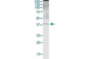 FBP1 MaxPab rabbit polyclonal antibody. (FBP1 抗体  (AA 1-338))