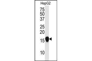 Image no. 2 for anti-Small Ubiquitin Related Modifier 4 (SUMO4) (Met55Val-Mutant) antibody (ABIN356787) (SUMO4 抗体  (Met55Val-Mutant))