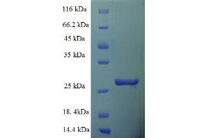 SDS-PAGE (SDS) image for Fracture Callus 1 Homolog (FXC1) (AA 1-103), (full length) protein (His-SUMO Tag) (ABIN5711983)