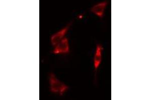 ABIN6274917 staining Hela cells by IF/ICC. (BST2 抗体  (Internal Region))