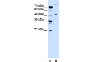 Western Blotting (WB) image for anti-Tripartite Motif Containing 42 (TRIM42) antibody (ABIN2462695) (TRIM42 抗体)