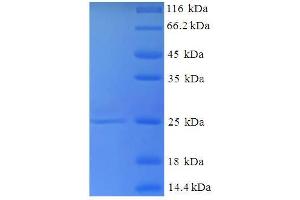 SDS-PAGE (SDS) image for Selenoprotein T (SELT) (AA 20-195) protein (His tag) (ABIN5710964) (SELT Protein (AA 20-195) (His tag))