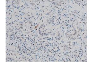 Immunohistochemistry (IHC) image for anti-Activating Transcription Factor 2 (ATF2) (pThr51), (pThr69) antibody (ABIN6256594)