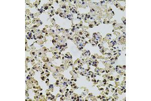 Immunohistochemistry of paraffin-embedded mouse lung using POT1 antibody (ABIN5970699) at dilution of 1/100 (40x lens). (POT1 抗体)