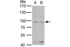 WB Image MLH1 antibody detects MLH1 protein by western blot analysis. (MLH1 抗体)
