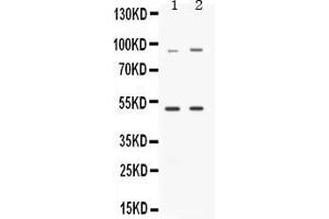 Western blot analysis of MAP3K8 expression in rat brain extract ( Lane 1) and HELA whole cell lysates ( Lane 2). (MAP3K8 抗体  (AA 9-193))