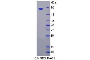SDS-PAGE analysis of Rat TLR3 Protein. (TLR3 蛋白)