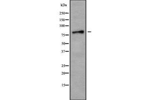 Western blot analysis USP49 using Jurkat whole cell lysates (USP49 抗体  (Internal Region))