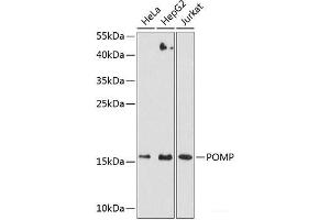 Western blot analysis of extracts of various cell lines using POMP Polyclonal Antibody at dilution of 1:3000. (POMP 抗体)