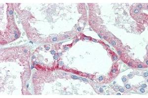 Detection of TMEM27 in Human Kidney Tissue using Polyclonal Antibody to Transmembrane Protein 27 (TMEM27)