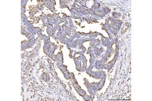 IHC analysis of PLP2 using anti-PLP2 antibody (ABIN7600320). (PLP2 抗体  (AA 18-152))