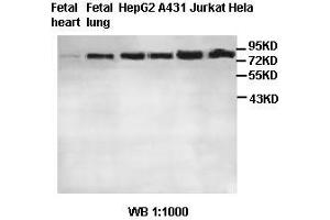 Image no. 2 for anti-MRE11 Meiotic Recombination 11 Homolog A (S. Cerevisiae) (MRE11A) antibody (ABIN791214) (Mre11 抗体)