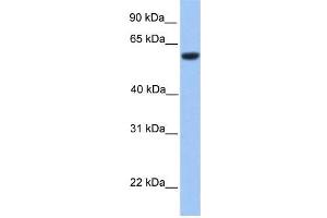 Human Brain; WB Suggested Anti-ZNF545 Antibody Titration: 0. (Zinc finger protein 82 homolog (ZFP82) (C-Term) 抗体)